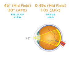 VOLK HR Direct Bi-Concave Lens VHRDBCACS