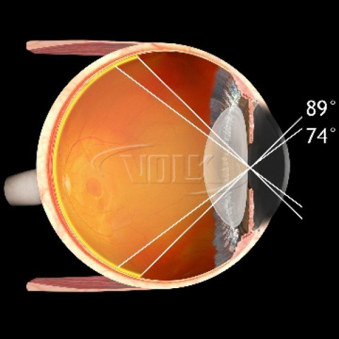 90D Lens VOLK V90C 90D Lens VOLK V90C