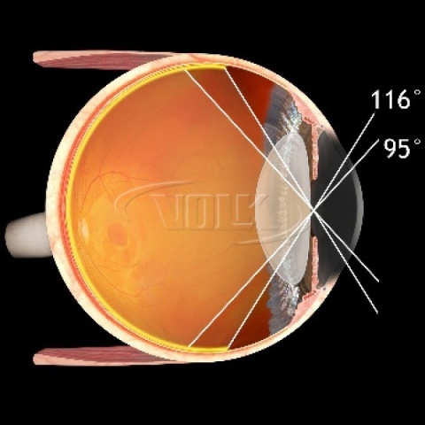 Volk Super Field Slit Lamp Lens Volk Super Field Slit Lamp Lens