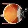 Soczewka Central Retinal ACS® VCRLVITACSSSV Soczewka Central Retinal ACS® VCRLVITACSSSV