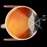 Soczewka SuperMacula® ( VSMACVIT ) Soczewka SuperMacula® ( VSMACVIT )